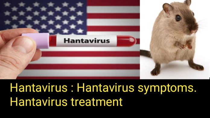 Hantavirus: hantavirus symptoms.hantavirus treatment